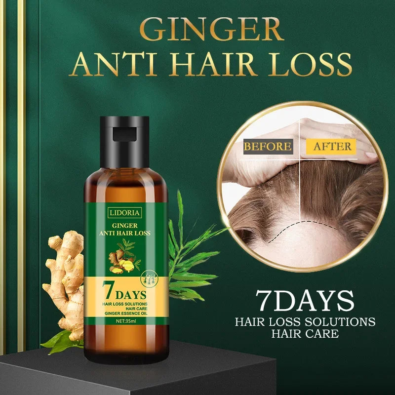 Ginger Hair Growth Essential Oil Anti-loss Hair Regrowth Serum Fast Growth Prevent Baldness Treatment Alopecia Hair Care Product