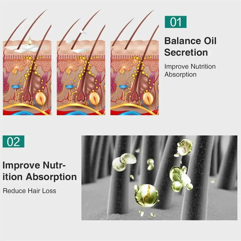 Ginger Hair Growth Essential Oil Anti-loss Hair Regrowth Serum Fast Growth Prevent Baldness Treatment Alopecia Hair Care Product
