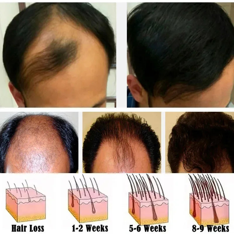 Ginger Hair Growth Essential Oil Anti-loss Hair Regrowth Serum Fast Growth Prevent Baldness Treatment Alopecia Hair Care Product