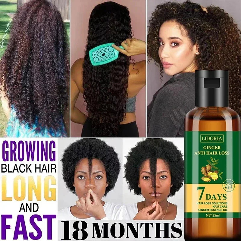 Ginger Hair Growth Essential Oil Anti-loss Hair Regrowth Serum Fast Growth Prevent Baldness Treatment Alopecia Hair Care Product